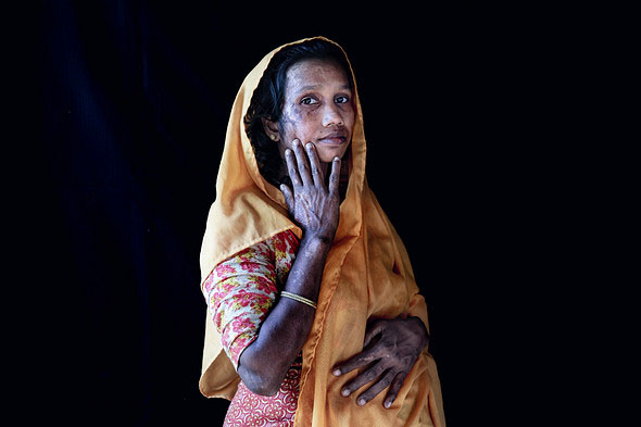 Rohingya Refugee Camp