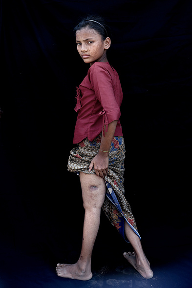 Rohingya Refugee Camp